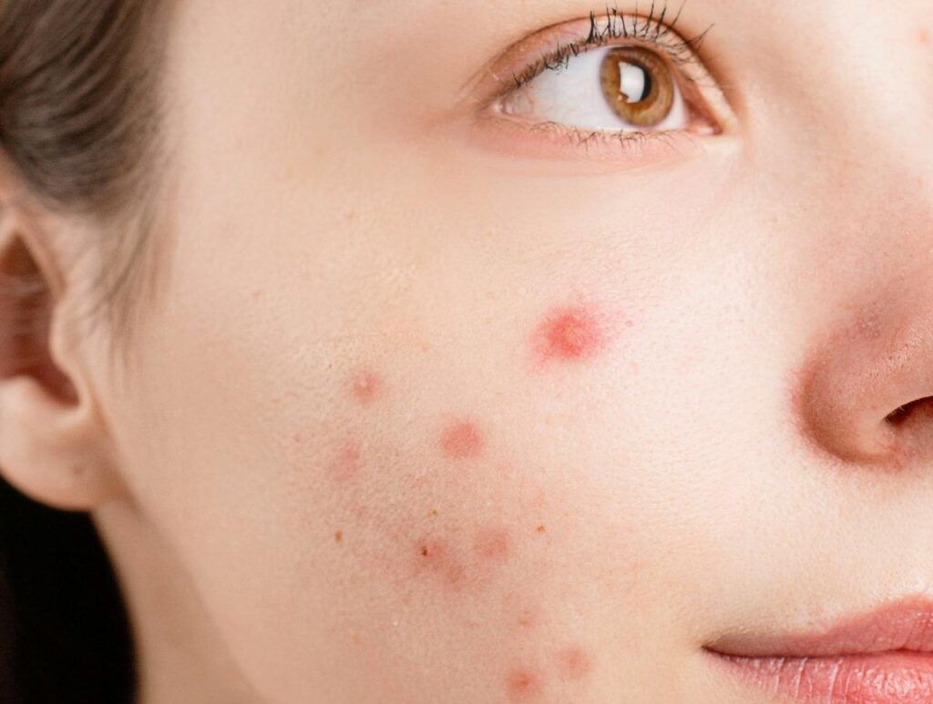 A-Close-Up-Shot-of-a-Woman-Face