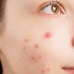 A-Close-Up-Shot-of-a-Woman-Face