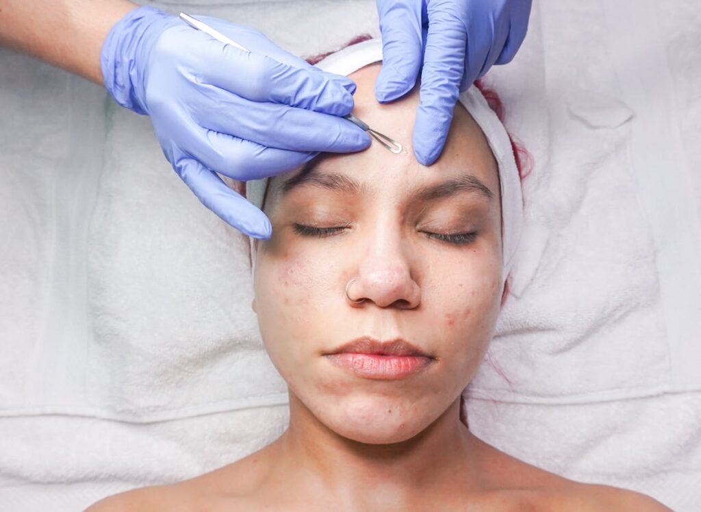 Skin-Care-Treatment-on-Woman-Face
