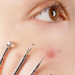 Womans-Face-With-Four-Skin-Extractor-Tools